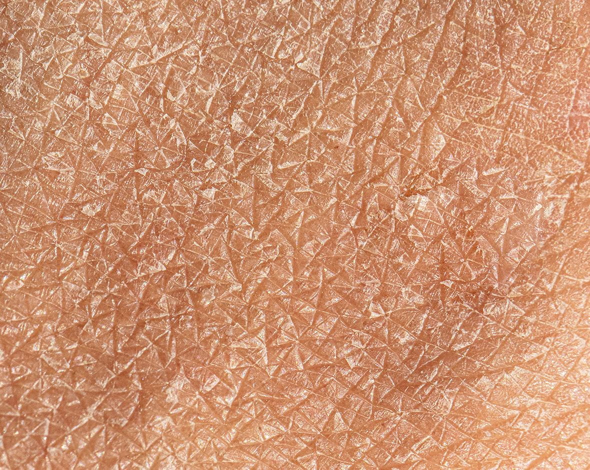 Productos para Piel Seca